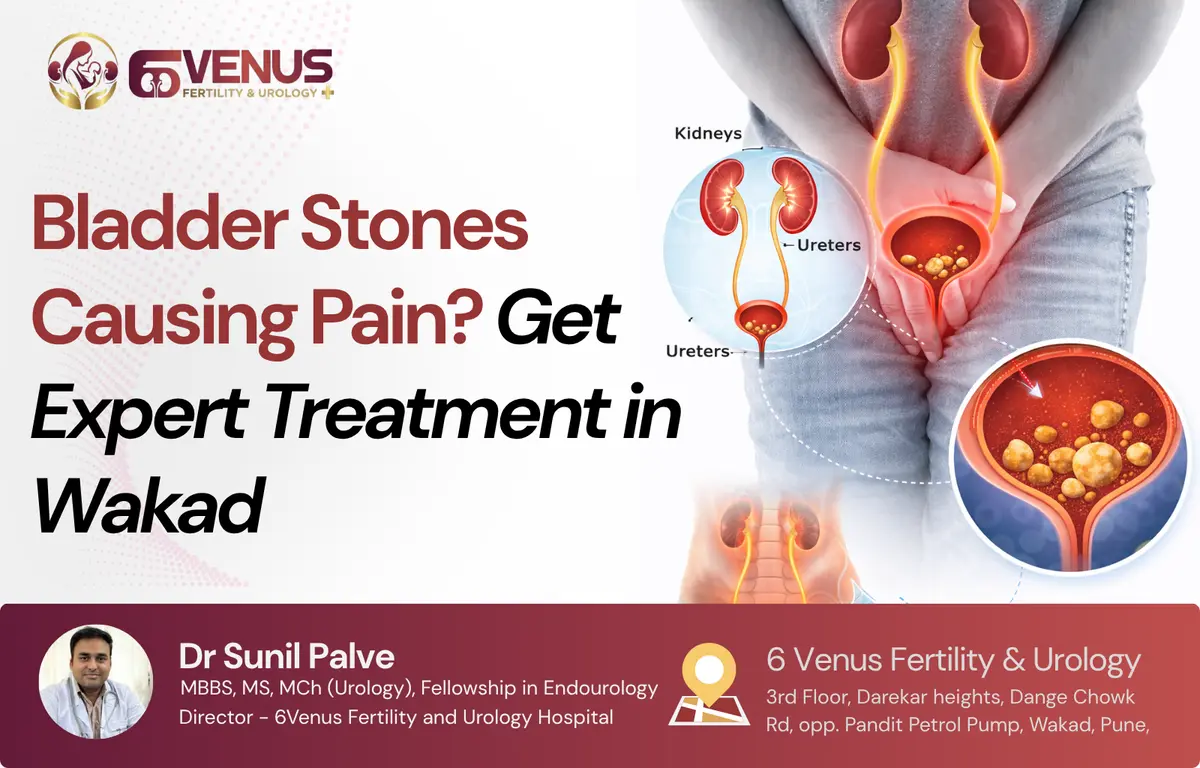 bladder stone treatment in Wakad Pune with advanced removal options