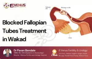 Blocked Fallopian Tubes Treatment in Wakad What Every Woman Needs to Know Before Choosing Surgery or IVF