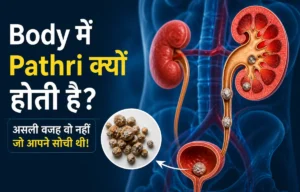body mein pathri kyu hoti hai kidney stone causes illustration