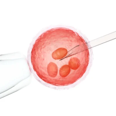 preimplantation